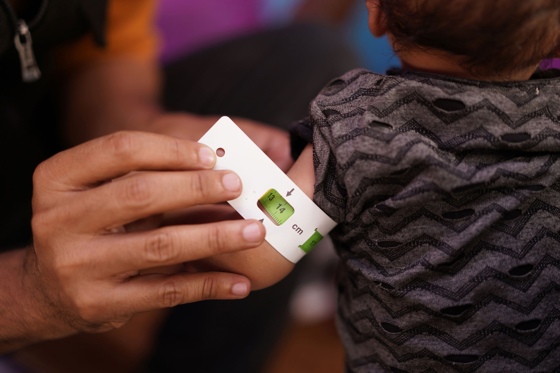 The mobile clinic team arrival to a modern tent in Al-Dhale'e, southern Yemen, in order to check on a 9-month old's  health condition.